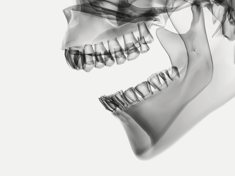 3D-Röntgen